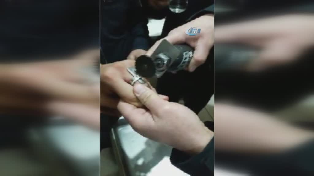 İtfaiyeden parmak kurtarma operasyonu