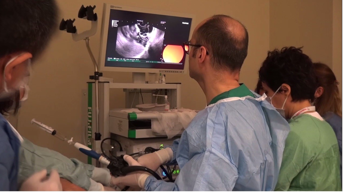 Türkiye’de az kullanılan yöntem Kayseri Şehir Hastanesinde başarı ile uygulandı