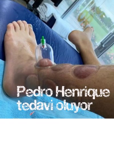 Pedro Henrique tedavi oluyor