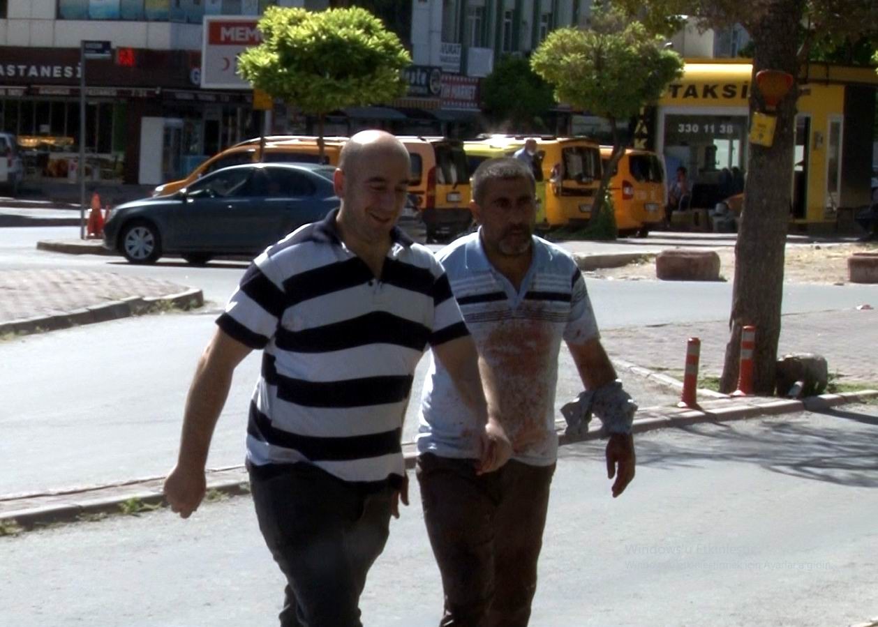 ACEMİ KASAPLAR HASTANELERE KOŞTU